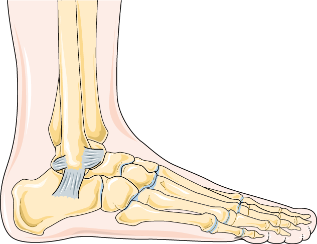 Ankle Arthritis