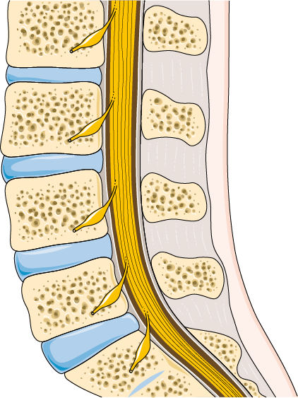 Cervical Spondylosis