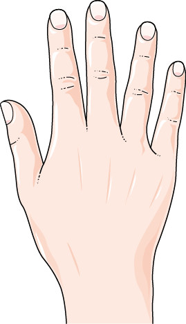 Complex Regional Pain Syndrome