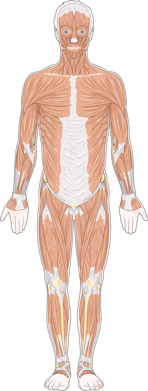 Fibromyalgia