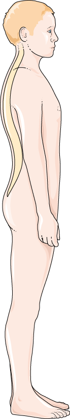 Spondylosis and Spondylitis