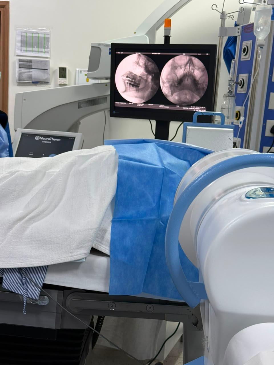 Gasserian Ganglion Radiofrequency Ablation at GABA Pain Center
