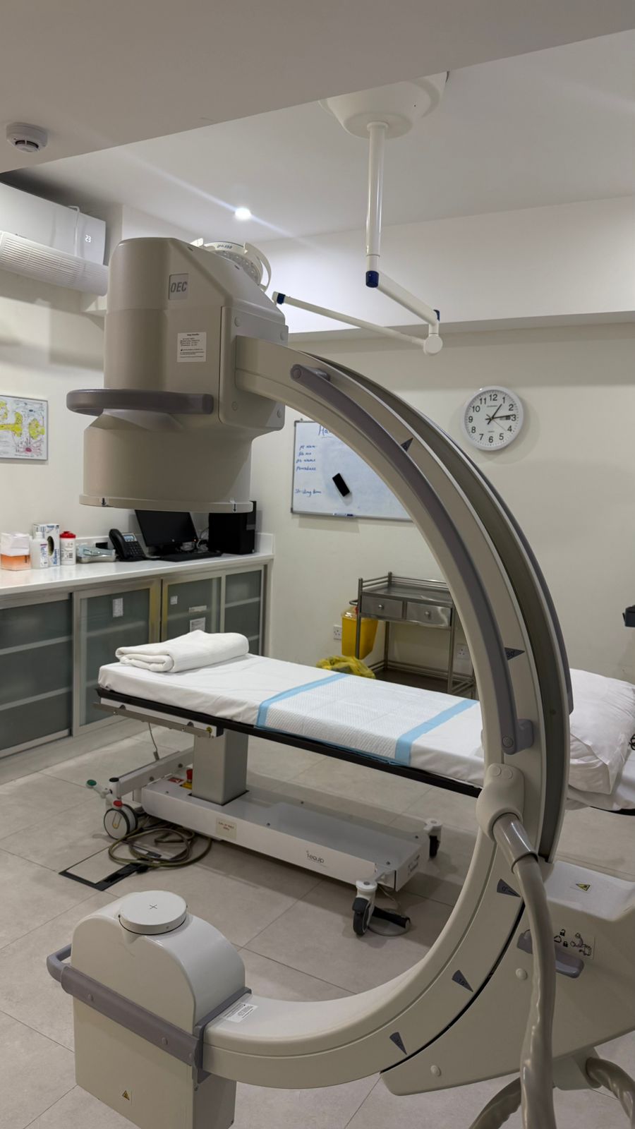 Radiofrequency Ablation